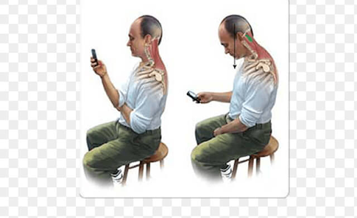 العلاج الطبيعي للرقبة